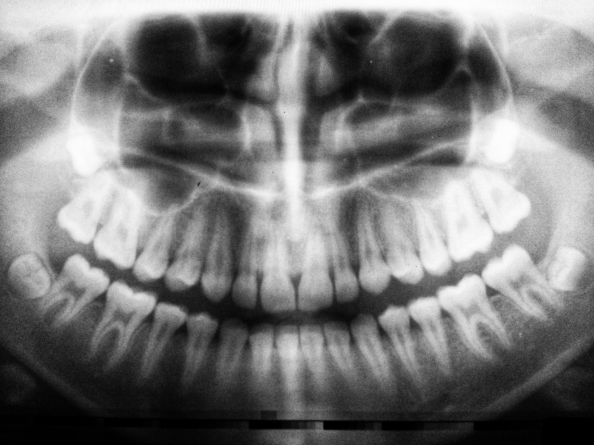 dental radiology fmx
